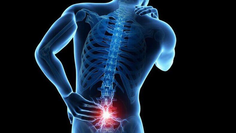 Simptomi ledvene osteohondroze